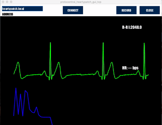 HeartyPatch Streaming ECG